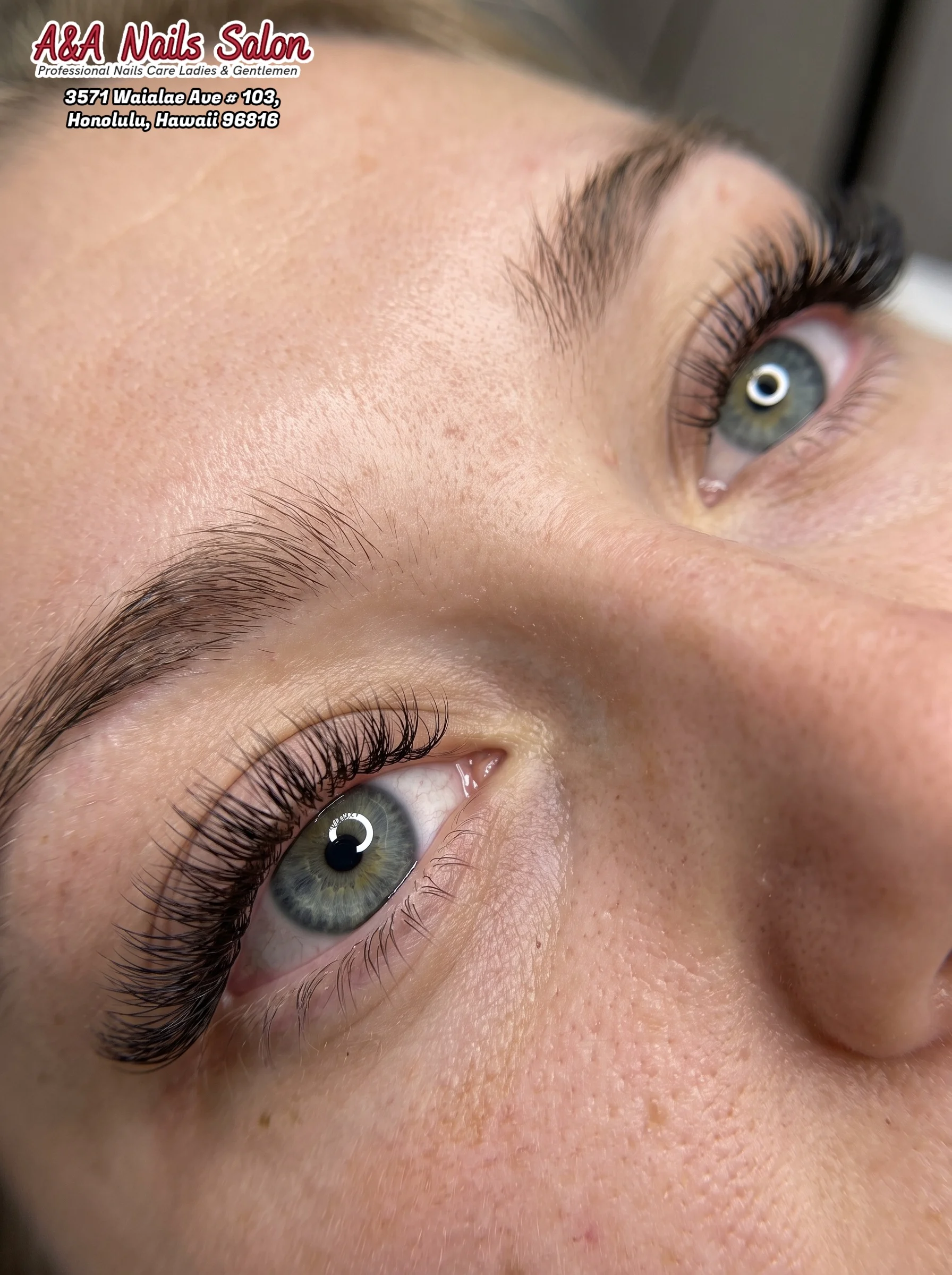 Eye